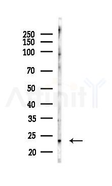 Bak Antibody - Western blot analysis of lysates from COLO205 cells(heat-shock 45min treatment), using Bak Antibody at 1/1000 dilution.