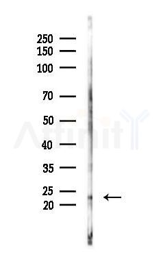 Claudin 1 Antibody - Western blot analysis of lysates from HUVEC cells(UV 30min treatment), using Claudin 1 Antibody at 1/1000 dilution.