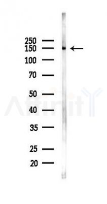 E-cadherin Antibody - Western blot analysis of lysates from Rat liver, using E-cadherin Antibody at 1/1000 dilution.