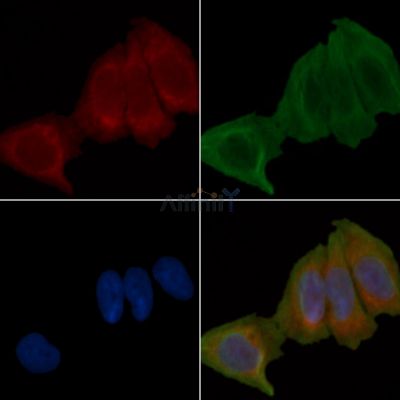 Fas Ligand Antibody - AF0157 staining Hela cells(30min of UV treatment) by IF/ICC.