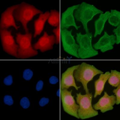 GAD1 Antibody - AF0163 staining Hela cells(30min of UV treatment) by IF/ICC.