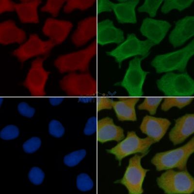 MMP7 Antibody - AF0218 staining Hela cells(30min of UV treatment) by IF/ICC.