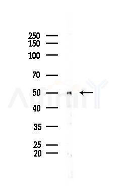 Parkin Antibody - Western blot analysis of lysates from COLO205 cells(heat-shock 45min treatment), using Parkin Antibody at 1/1000 dilution.