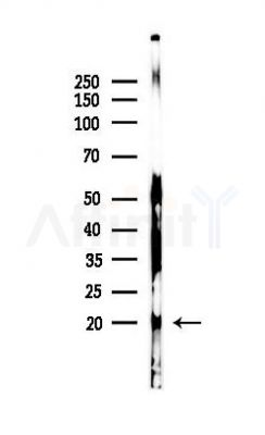 gamma Synuclein Antibody - Western blot analysis of lysates from Mouse brain, using gamma Synuclein Antibody at 1/1000 dilution.