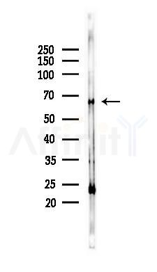 PIAS3 Antibody - Western blot analysis of lysates from Rat kidney, using PIAS3 Antibody at 1/1000 dilution.