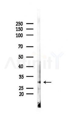 OVOL1 Antibody - Western blot analysis of lysates from Hela cells(heat-shock 45min treatment), using OVOL1 Antibody at 1/1000 dilution.