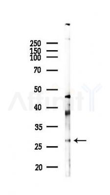 TNFSF14 Antibody - Western blot analysis of lysates from K562 cells(starvation 24h treatment), using TNFSF14 Antibody at 1/1000 dilution.