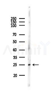 TNFSF14 Antibody - Western blot analysis of lysates from Rat lung, using TNFSF14 Antibody at 1/1000 dilution.