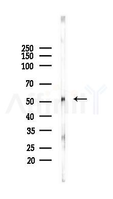 ETV4 Antibody - Western blot analysis of lysates from Rat testis, using ETV4 Antibody at 1/1000 dilution.
