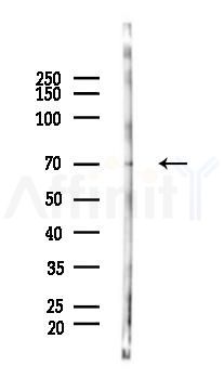 MAP3K3 Antibody - Western blot analysis of lysates from COLO205 cells(heat-shock 45min treatment), using MAP3K3 Antibody at 1/1000 dilution.