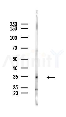 NT5C3 Antibody - Western blot analysis of lysates from Mouse lung, using NT5C3 Antibody at 1/1000 dilution.