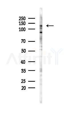 PKCB1 Antibody - Western blot analysis of lysates from K562 cells(LPS 4h treatment), using PKCB1 Antibody at 1/1000 dilution.