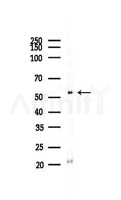 FKRP Antibody - Western blot analysis of lysates from COLO205 cells(heat-shock 45min treatment), using FKRP Antibody at 1/1000 dilution.