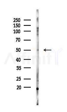 FKRP Antibody - Western blot analysis of lysates from COLO205 cells(heat-shock 45min treatment), using FKRP Antibody at 1/1000 dilution.