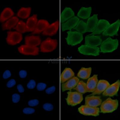 TRIP13 Antibody - AF0570 staining Hela cells(30min of UV treatment) by IF/ICC.