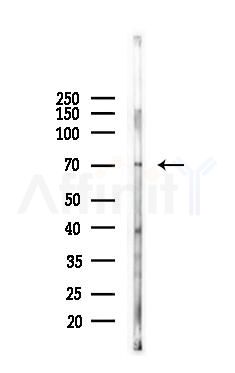 DMPK Antibody - Western blot analysis of lysates from Hela cells(heat-shock 45min treatment), using DMPK Antibody at 1/1000 dilution.