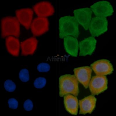 Collagen XIII  alpha 1 Antibody - AF0598 staining Hela cells(45min of heat-shock treatment) by IF/ICC.