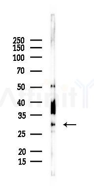 DDIT3/CHOP Antibody - Western blot analysis of lysates from Mouse muscle, using DDIT3/CHOP Antibody at 1/1000 dilution.