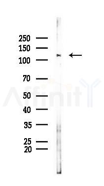 Nrf2 Antibody - Western blot analysis of lysates from PC12 cells(LPS 4h treatment), using Nrf2 Antibody at 1/1000 dilution.