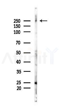 Fibronectin Antibody - Western blot analysis of lysates from Hela cells(heat-shock 45min treatment), using Fibronectin Antibody at 1/1000 dilution.