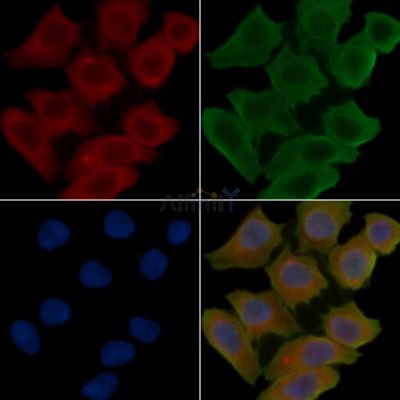 Fibronectin Antibody - AF0738 staining Hela cells(30min of UV treatment) by IF/ICC.