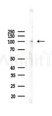FAP1 Antibody - Western blot analysis of lysates from Hela cells(UV 30min treatment), using FAP1 Antibody at 1/1000 dilution.