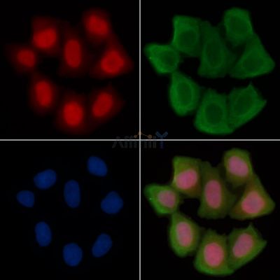 TOP2A Antibody - AF0793 staining Hela cells(30min of UV treatment) by IF/ICC.