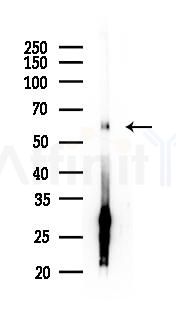 AKT1 Antibody - Western blot analysis of lysates from HUVEC cells(starvation 24h treatment), using AKT1 Antibody at 1/1000 dilution.