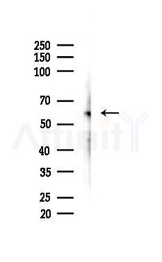AKT1 Antibody - Western blot analysis of lysates from Hela cells(LPS 4h treatment), using AKT1 Antibody at 1/1000 dilution.