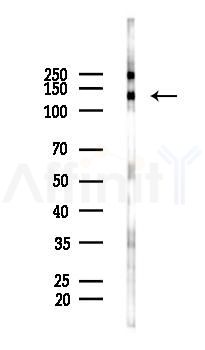 Phospho-JAK1 (Tyr1022)[Tyr1034] Antibody - Western blot analysis of lysates from PC12 cells(LPS 4h treatment), using Phospho-JAK1 (Tyr1022)[Tyr1034] Antibody at 1/1000 dilution.