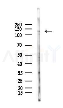 Phospho-JAK1 (Tyr1022)[Tyr1034] Antibody - Western blot analysis of lysates from PC12 cells(UV 30min treatment), using Phospho-JAK1 (Tyr1022)[Tyr1034] Antibody at 1/1000 dilution.