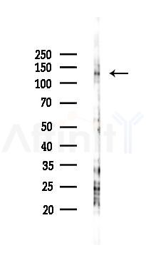 Phospho-JAK1 (Tyr1022)[Tyr1034] Antibody - Western blot analysis of lysates from HUVEC cells(starvation 24h treatment), using Phospho-JAK1 (Tyr1022)[Tyr1034] Antibody at 1/1000 dilution.