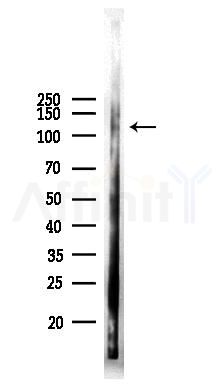 Phospho-ULK1 (Ser317) Antibody - Western blot analysis of lysates from PC12 cells(LPS 4h treatment), using Phospho-ULK1 (Ser317) Antibody at 1/1000 dilution.