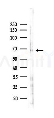 Phospho-CDC25B (Ser151) Antibody - Western blot analysis of lysates from COLO205 cells(LPS 4h treatment), using Phospho-CDC25B (Ser151) Antibody at 1/1000 dilution.