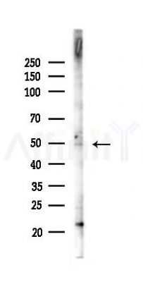 Phospho-MEK1 (Thr286) Antibody - Western blot analysis of lysates from COLO205 cells(LPS 4h treatment), using Phospho-MEK1 (Thr286) Antibody at 1/1000 dilution.