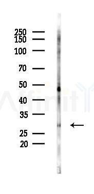 Phospho-MFF (Ser172/Ser146) Antibody - Western blot analysis of lysates from 293 cells(LPS 4h treatment), using Phospho-MFF (Ser172/Ser146) Antibody at 1/1000 dilution.