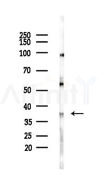 Phospho-MFF (Ser172/Ser146) Antibody - Western blot analysis of lysates from Rat kidney, using Phospho-MFF (Ser172/Ser146) Antibody at 1/1000 dilution.