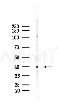 Phospho-p40 phox (Thr154) Antibody - Western blot analysis of lysates from K562 cells(heat-shock 45min treatment), using Phospho-p40 phox (Thr154) Antibody at 1/1000 dilution.