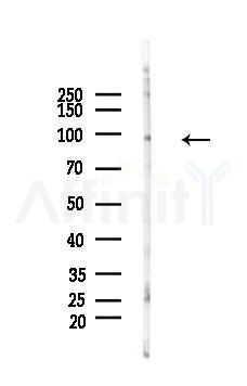 Phospho-PSD95 (Ser295) Antibody - Western blot analysis of lysates from Mouse brain, using Phospho-PSD95 (Ser295) Antibody at 1/1000 dilution.