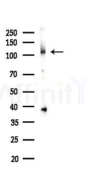 Phospho-Retinoblastoma (Ser608) Antibody - Western blot analysis of lysates from COLO205 cells(LPS 4h treatment), using Phospho-Retinoblastoma (Ser608) Antibody at 1/1000 dilution.