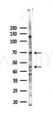 Phospho-RIPK1 (Ser166) Antibody - Western blot analysis of lysates from COLO205 cells(LPS 4h treatment), using Phospho-RIPK1 (Ser166) Antibody at 1/1000 dilution.