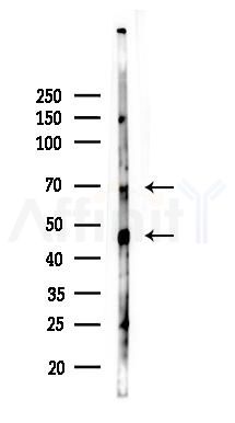 Phospho-RIPK1 (Ser166) Antibody - Western blot analysis of lysates from PC12 cells(starvation 24h treatment), using Phospho-RIPK1 (Ser166) Antibody at 1/1000 dilution.