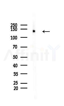 Phospho-TIE2 (Tyr992) Antibody - Western blot analysis of lysates from HUVEC cells(heat-shock 45min treatment), using Phospho-TIE2 (Tyr992) Antibody at 1/1000 dilution.