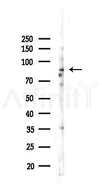 Phospho-TLK1 (Ser743) Antibody - Western blot analysis of lysates from COLO205 cells(LPS 4h treatment), using Phospho-TLK1 (Ser743) Antibody at 1/1000 dilution.