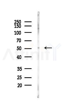 Phospho-TRAF2 (Ser11) Antibody - Western blot analysis of lysates from B16F10-LUC cells(UV 30min treatment), using Phospho-TRAF2 (Ser11) Antibody at 1/1000 dilution.