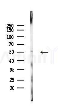 Phospho-TRAF2 (Ser11) Antibody - Western blot analysis of lysates from Hela cells(heat-shock 45min treatment), using Phospho-TRAF2 (Ser11) Antibody at 1/1000 dilution.