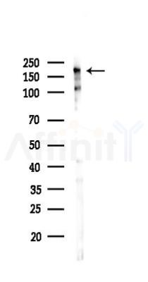 Phospho-Tuberin/TSC2 (Ser939) Antibody - Western blot analysis of lysates from PC12 cells(starvation 24h treatment), using Phospho-Tuberin/TSC2 (Ser939) Antibody at 1/1000 dilution.