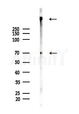 VWF Antibody - Western blot analysis of lysates from Rat lung, using VWF Antibody at 1/1000 dilution.