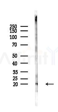 Phospho-Survivin (Thr117) Antibody - Western blot analysis of lysates from Mouse lung, using Phospho-Survivin (Thr117) Antibody at 1/1000 dilution.