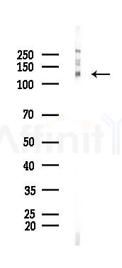 Phospho-JAK2 (Tyr931) Antibody - Western blot analysis of lysates from HUVEC cells(UV 30min treatment), using Phospho-JAK2 (Tyr931) Antibody at 1/1000 dilution.